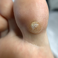 Soins pédicure